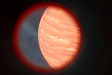 EXPEDITION ZUM NEESBECK